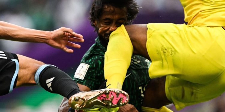 السعودية تخسر لاعبين في المونديال بعد ملحمة الارجنتين